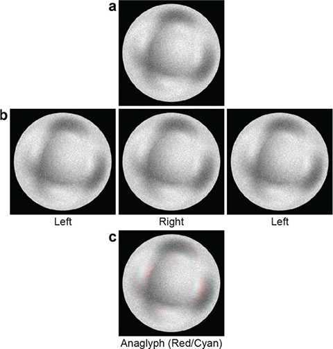 Fig 0001