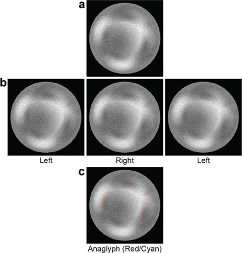 Fig 0003